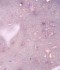 Гел за изграждане Dark Medium Potal Gel №02 15 мл